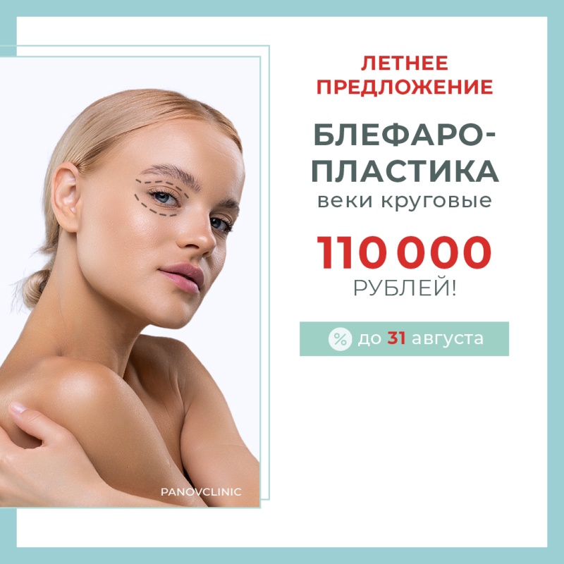 АКЦИЯ НА БЛЕФАРОПЛАСТИКУ
